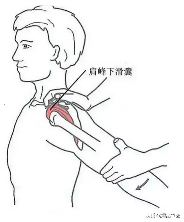颈肩病常见的几个压痛点!治疗颈肩不适,经典好文章