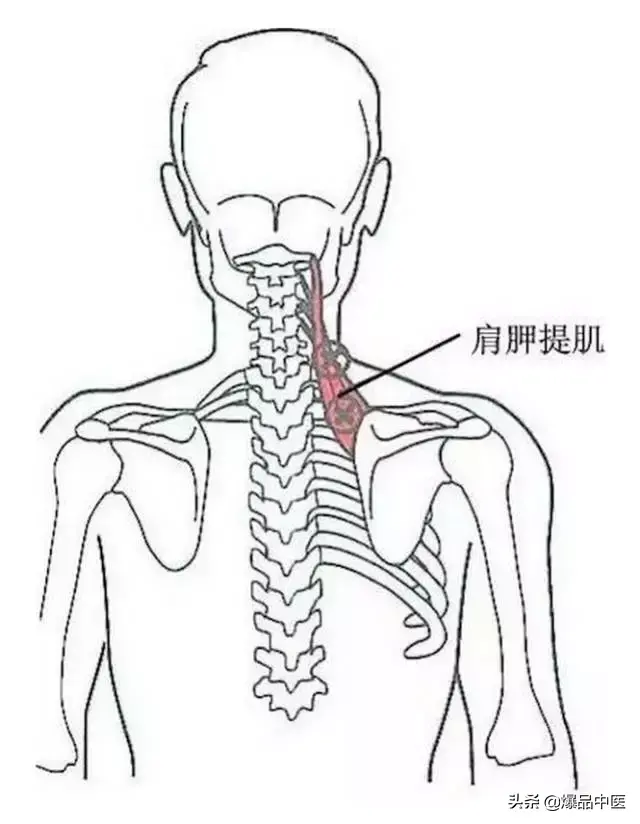 颈肩病常见的几个压痛点!治疗颈肩不适,经典好文章