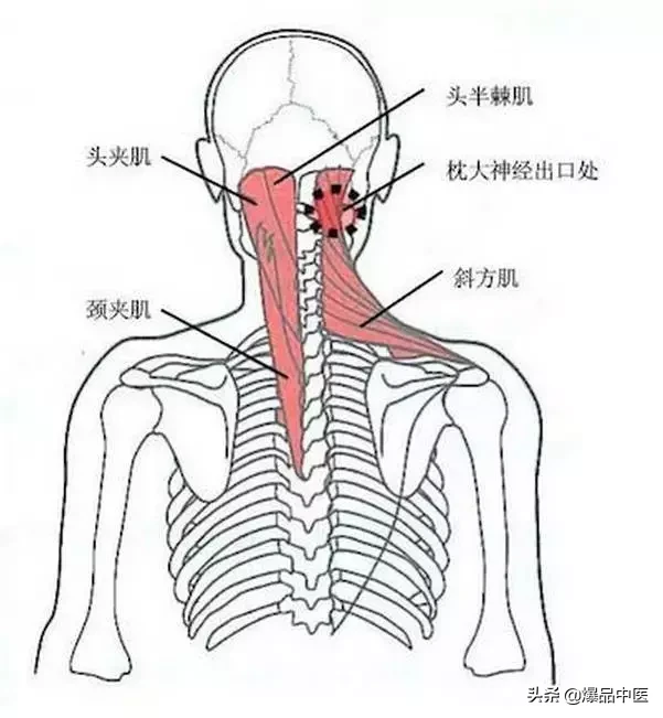 颈肩病常见的几个压痛点!治疗颈肩不适,经典好文章
