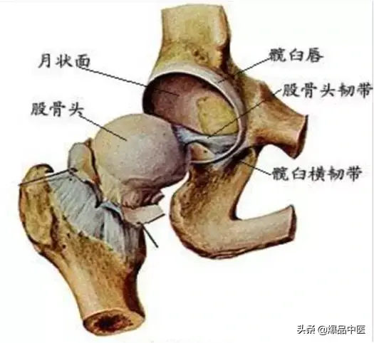股骨头坏死的诊断与治疗策略,康源干货分享