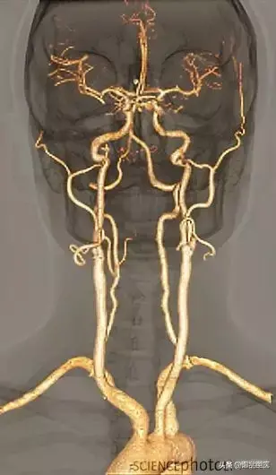 神经系统一天搞定,打破死板记忆方法