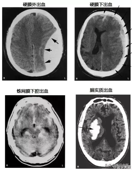 神经系统一天搞定,打破死板记忆方法