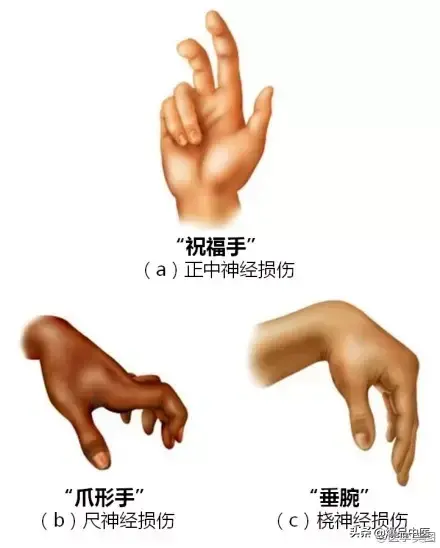 神经系统一天搞定,打破死板记忆方法