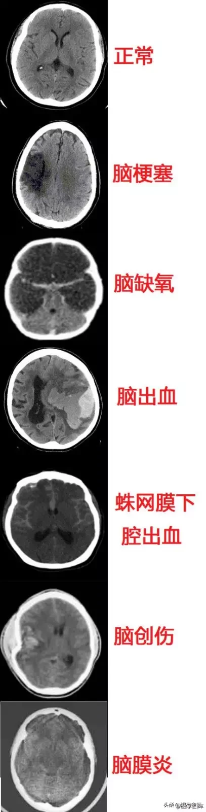 神经系统一天搞定,打破死板记忆方法