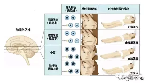 神经系统一天搞定,打破死板记忆方法