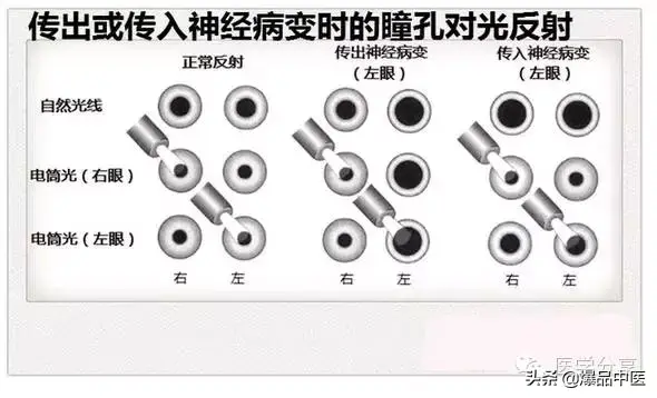 神经系统一天搞定,打破死板记忆方法