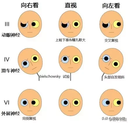 神经系统一天搞定,打破死板记忆方法