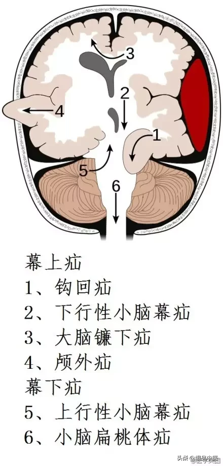 神经系统一天搞定,打破死板记忆方法