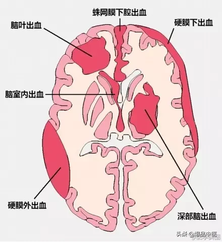 神经系统一天搞定,打破死板记忆方法