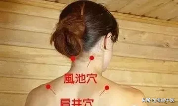 刺络放血,大病小病都不怕