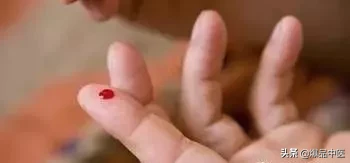 刺络放血,大病小病都不怕