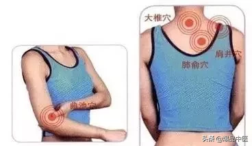 刺络放血,大病小病都不怕
