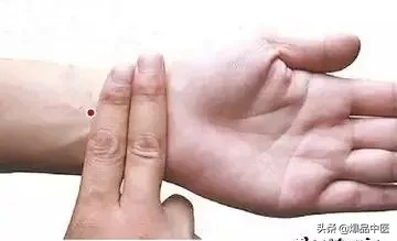 刺络放血,大病小病都不怕
