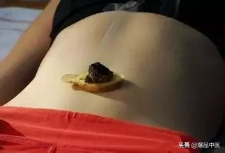 女人养颜重点:如何养好任脉