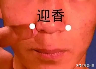 穴位就是中药,经络就是药房