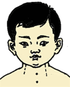 小儿推拿手法大全(动画演示)