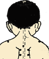 小儿推拿手法大全(动画演示)