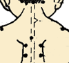 小儿推拿手法大全(动画演示)