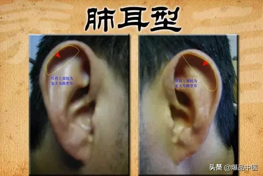 你知道耳朵泄露的健康秘密吗？观耳知五脏疾病