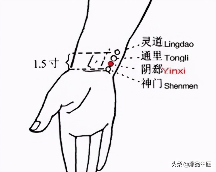 牢记全身疾病特效穴,专穴专用