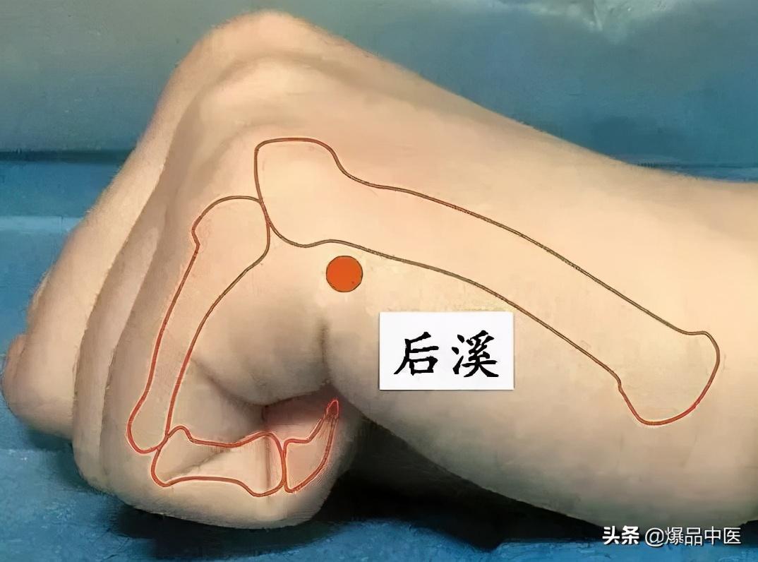 牢记全身疾病特效穴,专穴专用
