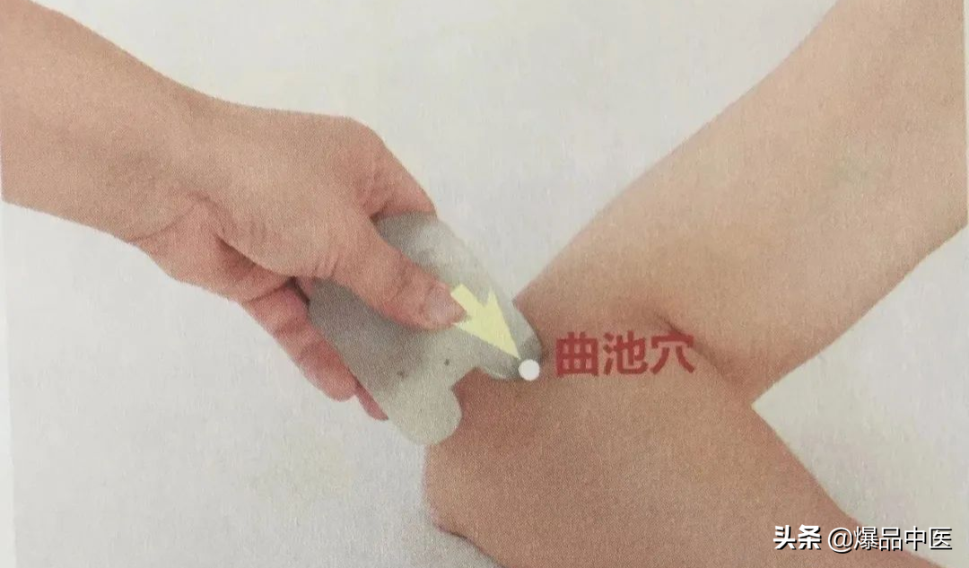 牢记全身疾病特效穴,专穴专用