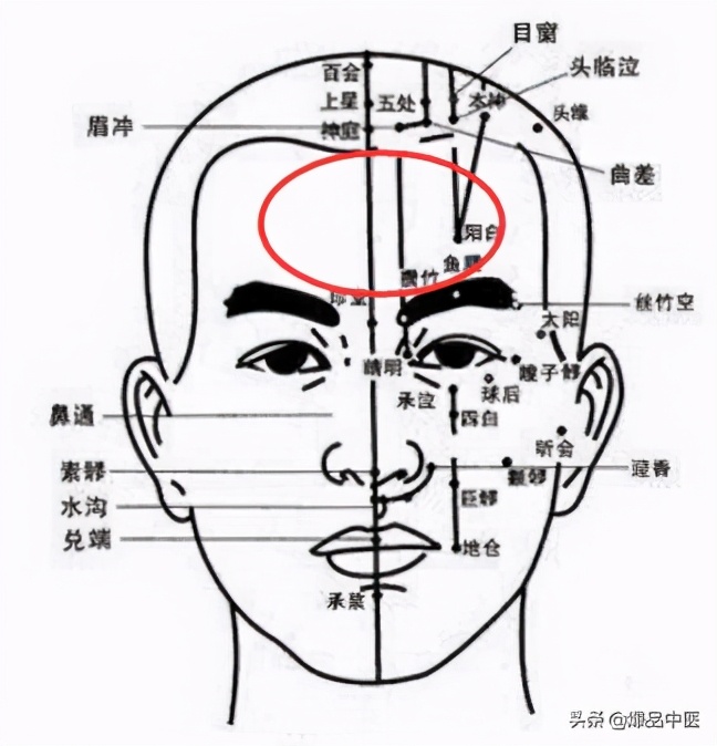 手上有四个穴位,可治疗一切头疼