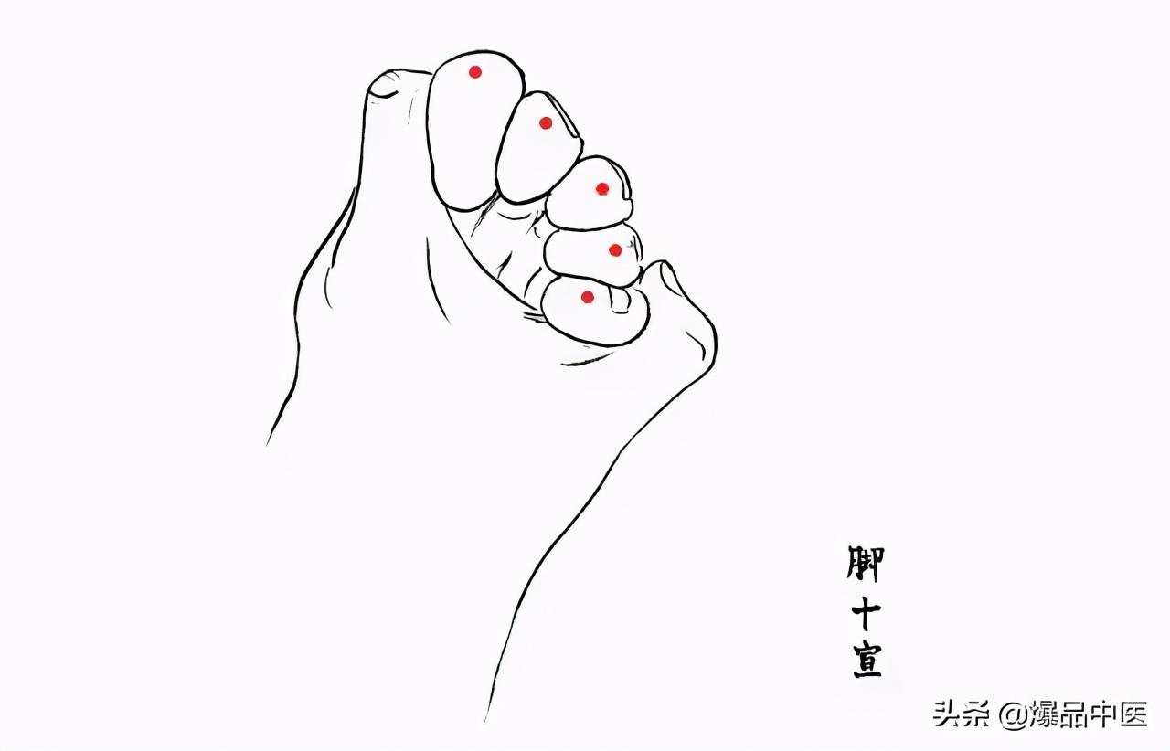 针灸急救,被淡忘的最好急救术