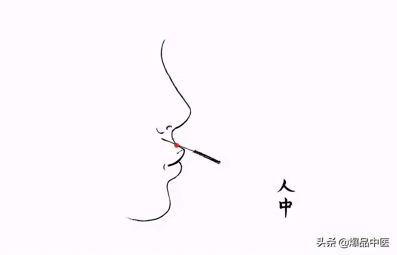 针灸急救,被淡忘的最好急救术