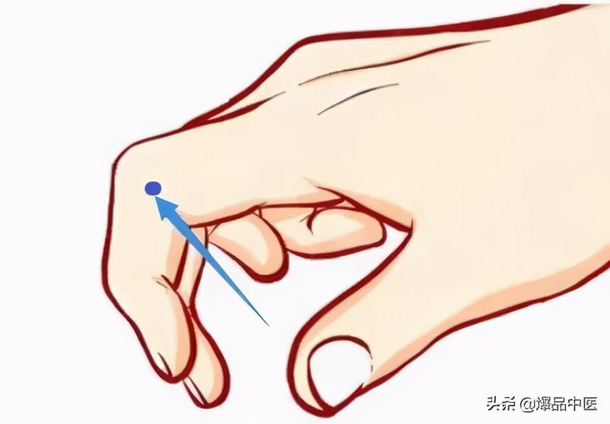 手上有四个穴位,可治疗一切头疼
