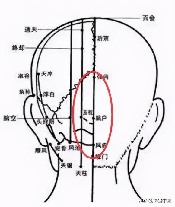 手上有四个穴位,可治疗一切头疼