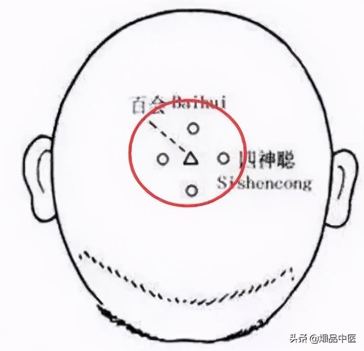 手上有四个穴位,可治疗一切头疼
