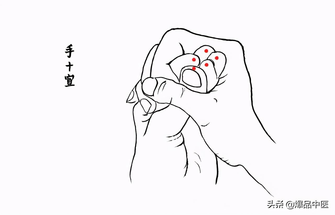 针灸急救,被淡忘的最好急救术