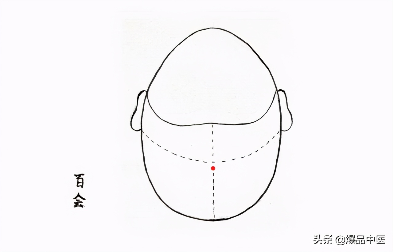针灸急救,被淡忘的最好急救术