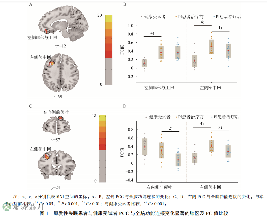 核磁共振治疗失眠的效果.png