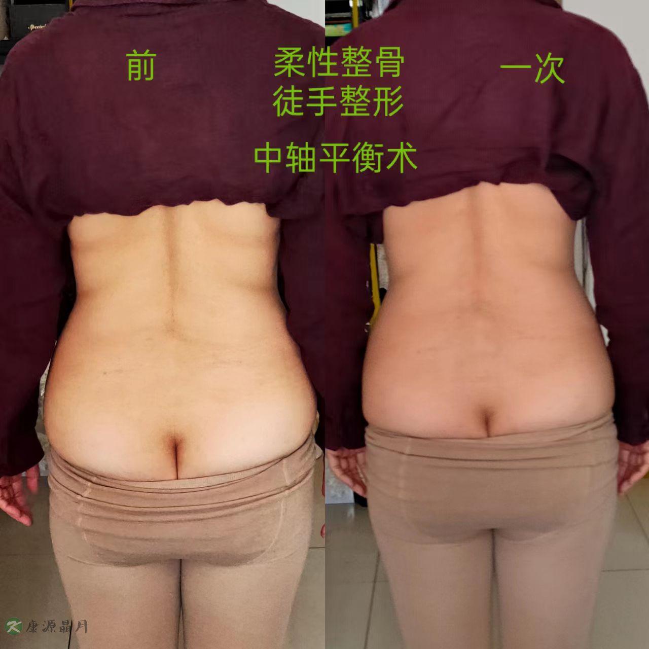 整骨.jpg