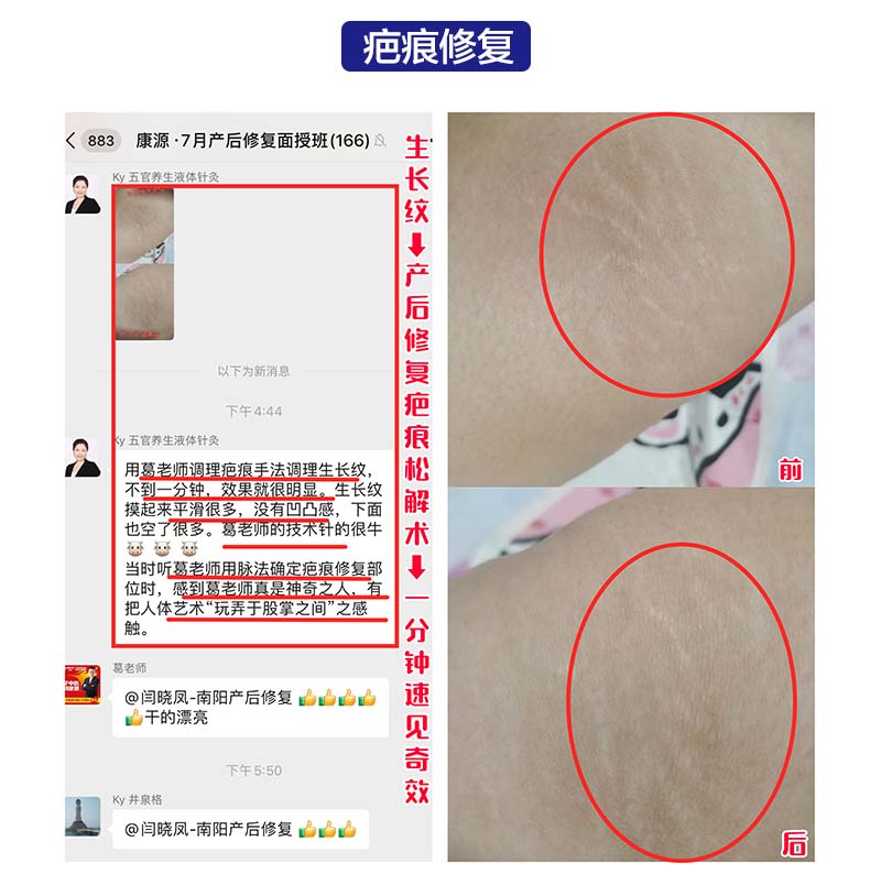 力学产后修复013.jpg