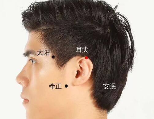 耳尖放血治病.jpg