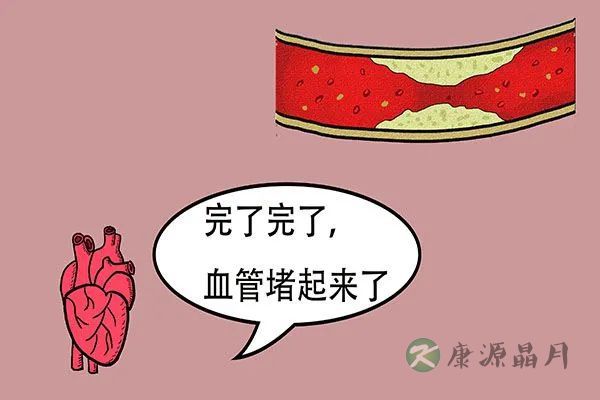 血管白塞.jpg