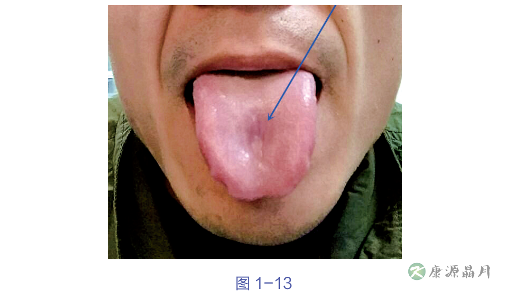 舌诊定位诊断.png