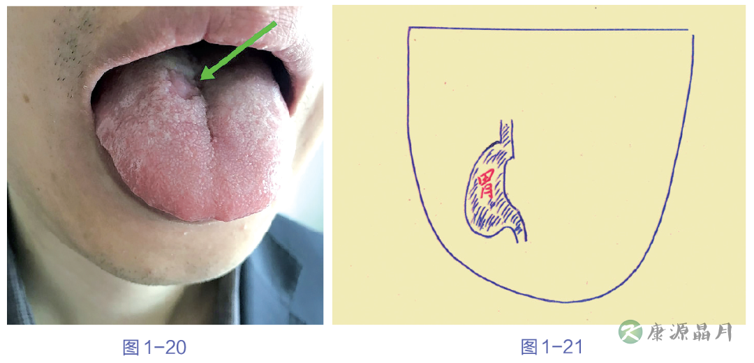 舌表面异常.png